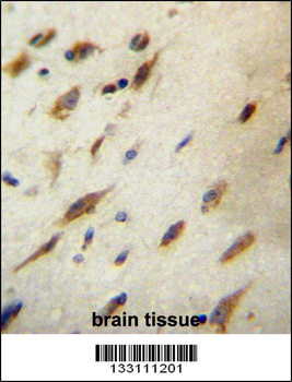 CCDC134 Antibody (C-term)
