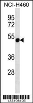 RTDR1 Antibody (N-term)