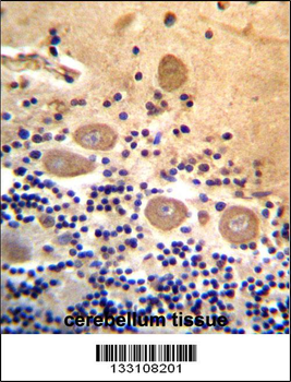 RTDR1 Antibody (N-term)