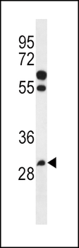 PGAP3 Antibody (Center)