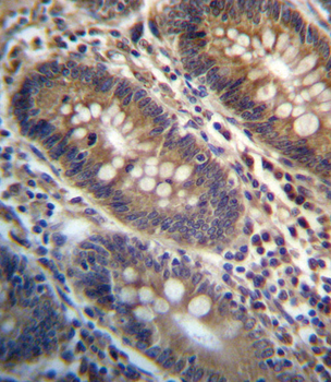 PGAP3 Antibody (Center)