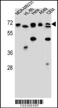 ASMTL Antibody (Center)