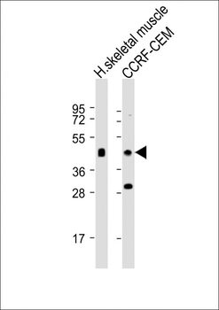 SLC16A10 Antibody (C-term)