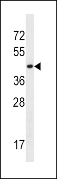 SLC16A10 Antibody (C-term)