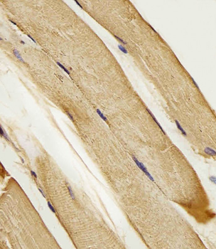 SLC16A10 Antibody (C-term)