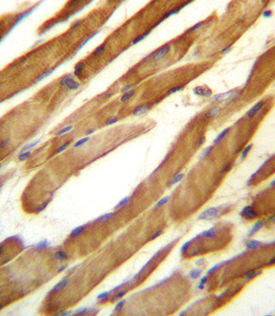 SLC16A10 Antibody (C-term)