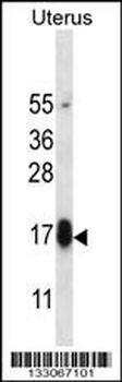 GPHB5 Antibody (C-term)
