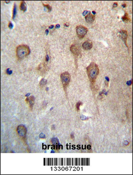 GPHB5 Antibody (C-term)