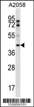 FIBP Antibody (Center)