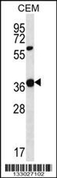 WNT16 Antibody (C-term)