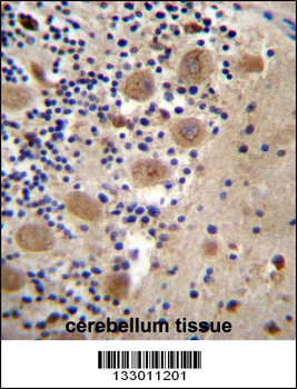 AFG3L2 Antibody (N-term)