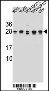 RAB3D Antibody (C-term)