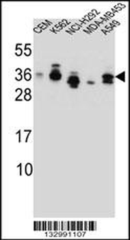 SSX4 Antibody (Center)