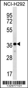 THAP8 Antibody (Center)