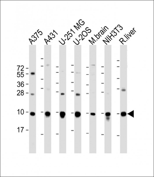 RPL34 Antibody (Center)