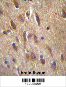 FGF11 Antibody (N-term)