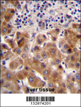 PSORS1C1 Antibody (N-term)