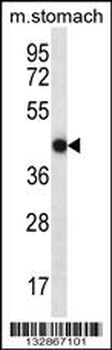FGD2 Antibody (C-term)