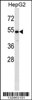 CHST9 Antibody (N-term)