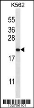 GAGE2B Antibody (N-term)