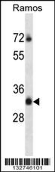 TM55B Antibody (C-term)