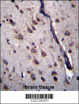 DYSFIP1 Antibody (N-term)