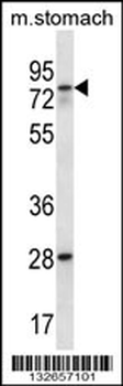 WBSCR17 Antibody (C-term)