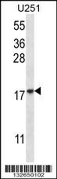 EIF1AY Antibody (N-term)