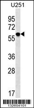 TM9SF2 Antibody (N-term)