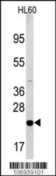 Bad Antibody (Center)