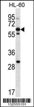 NPTXR Antibody (Center)