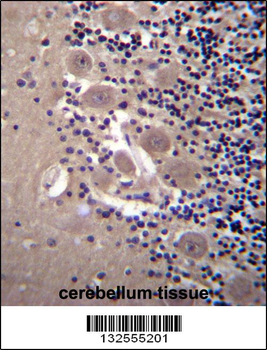 NPTXR Antibody (Center)