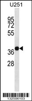 CD320 Antibody (C-term)