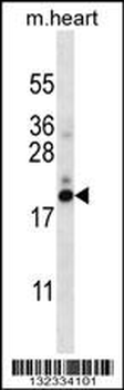 PFDN5 Antibody (Center)