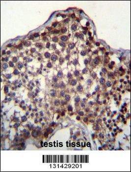 PQLC2 Antibody (C-term)