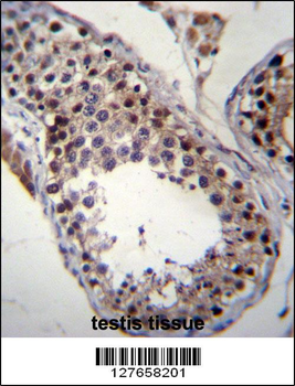 SPT19 Antibody (C-term)