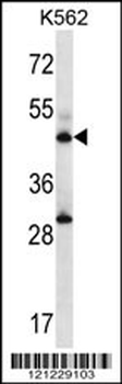 ADSS Antibody (C-term)