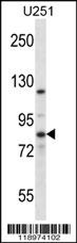 EIF2B5 Antibody (N-term)