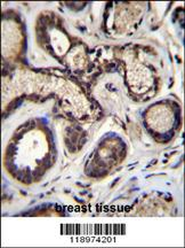 EIF2B5 Antibody (N-term)