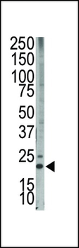 Bim BH3 Domain Antibody