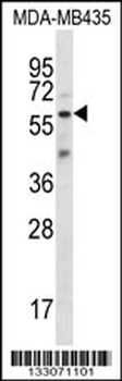 FSCN3 Antibody (C-term)