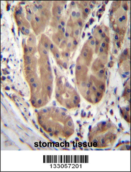ABHD2 Antibody (Center)