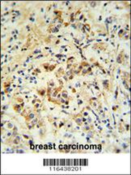 mouse BID Antibody (S61)