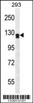 UNC5D Antibody (Center)