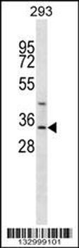 GLYAT Antibody (Center)
