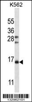 FSHB/FSH Antibody (Center)