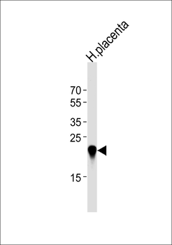 CSHL1 Antibody (C-term)