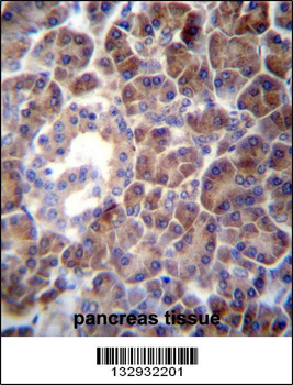 PTDSS2 Antibody (N-term)
