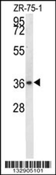 NIT1 Antibody (C-term)