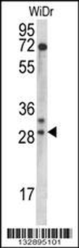 MRPL9 Antibody (N-term)